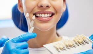 Dental Veneers in Granbury
